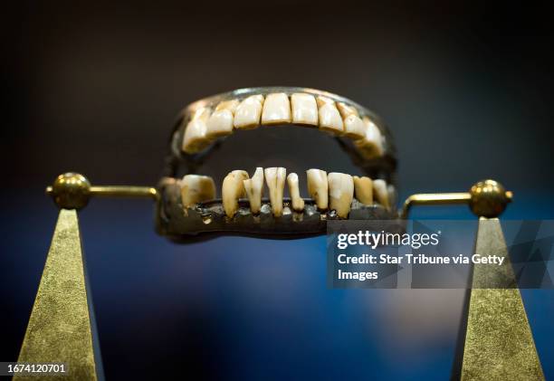 President George Washington's only complete set of dentures, made out of lead, human teeth, cow teeth and elephant ivory, photographed Wednesday,...
