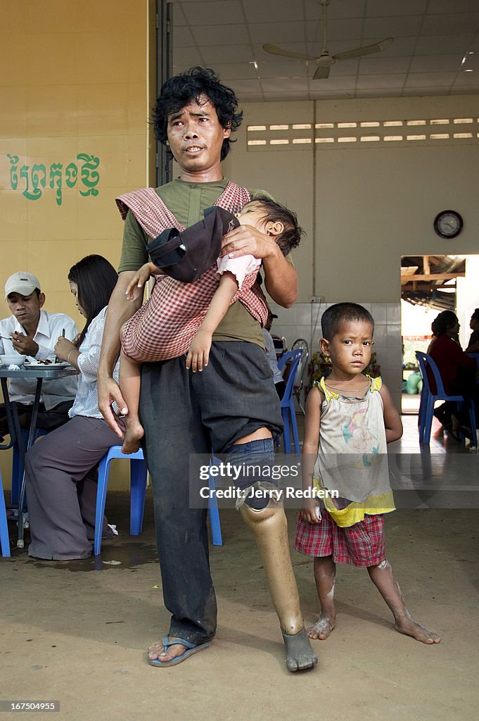 Nyol, a former soldier who stepped on a landmine, begs at a...