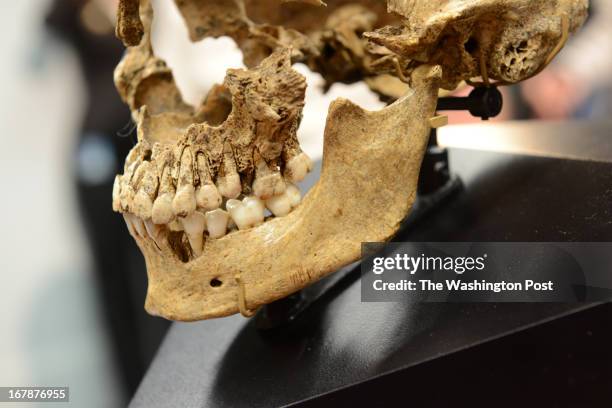 View of sharp cuts on the human jaw bone of "Jane", a 17th teenager from Jamestown at the Museum of Natural History in Washington, DC on May 1, 2013....