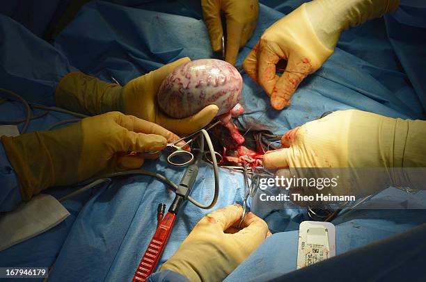 Veteriniarians remove a testicle from a horse during castration at the Dueppel animal clinic on April 25, 2013 in Berlin, Germany. The Dueppel clinic...