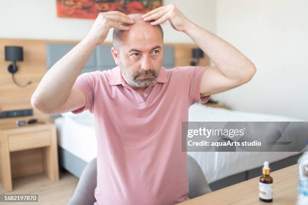 scalp massage for baldness treatment - man head massage stock pictures, royalty-free photos & images