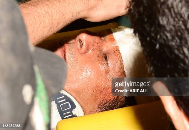 Suffering with head injuries, Pakistani politician and former cricketer Imran Khan is carried by rescuers as they rush to the hospital in Lahore on...