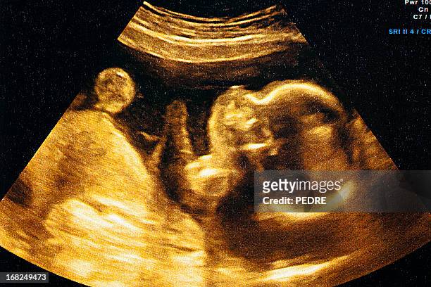 ecografia del feto - embrione foto e immagini stock
