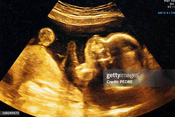 ultrasound of a woman's fetus at 37 weeks - pregnant belly stockfoto's en -beelden