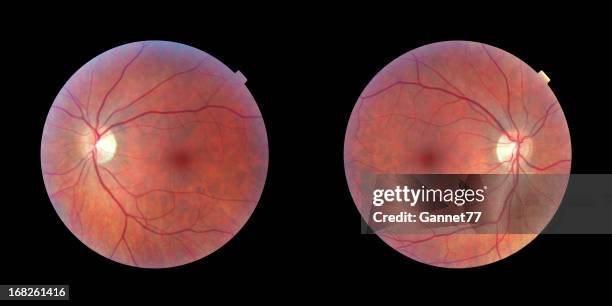 human retinas - left and right eye - optic nerve stock pictures, royalty-free photos & images