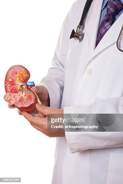 rene umano - kidney stone foto e immagini stock