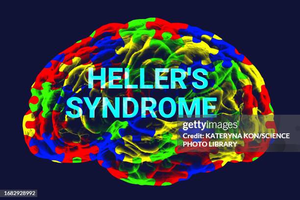 heller's syndrome, conceptual illustration - agreement stock illustrations