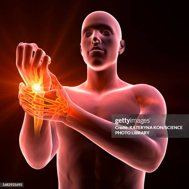 wrist pain, illustration - arthritis hand 3d stock illustrations