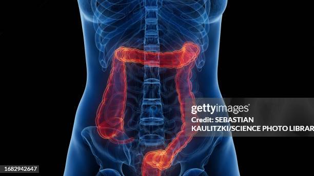 Lower Inntestine 96 Lower Intestine Stock Photos, High-Res Pictures, and Images - Getty ...