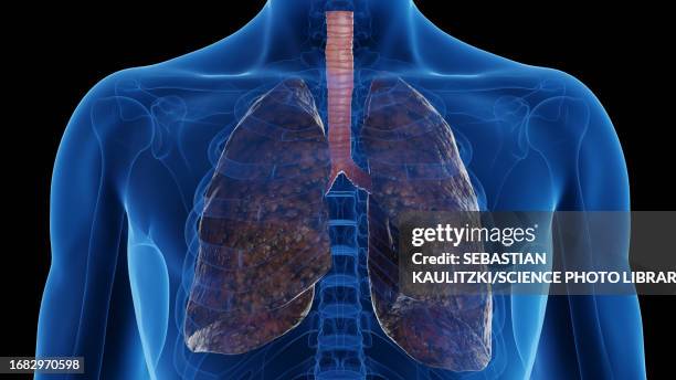 smoker's lungs, illustration - lung damage stock illustrations