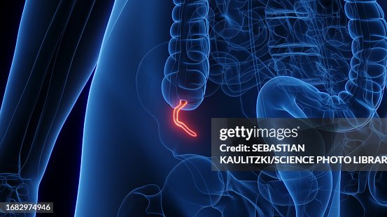 Apendix Colour Female Appendix Illustration High-Res Vector Graphic - Getty Images