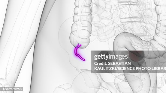 Labelled Appendix Graphic Female Appendix Illustration High-Res Vector Graphic - Getty Images