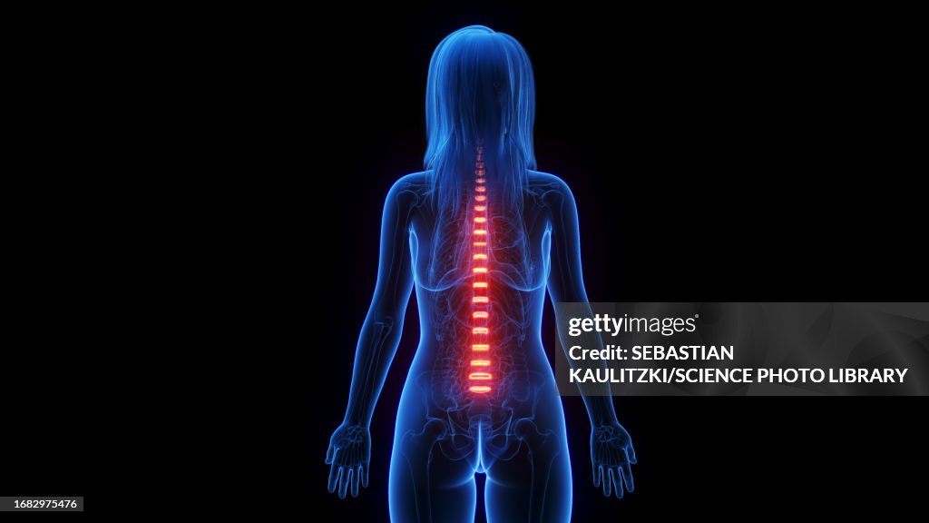 Female intervertebral discs, illustration