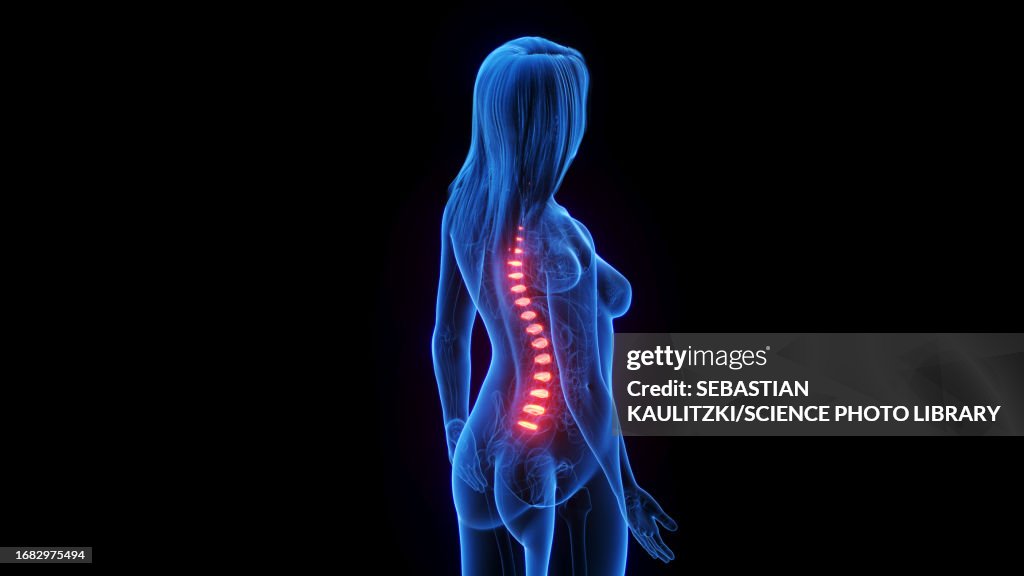 Female intervertebral discs, illustration