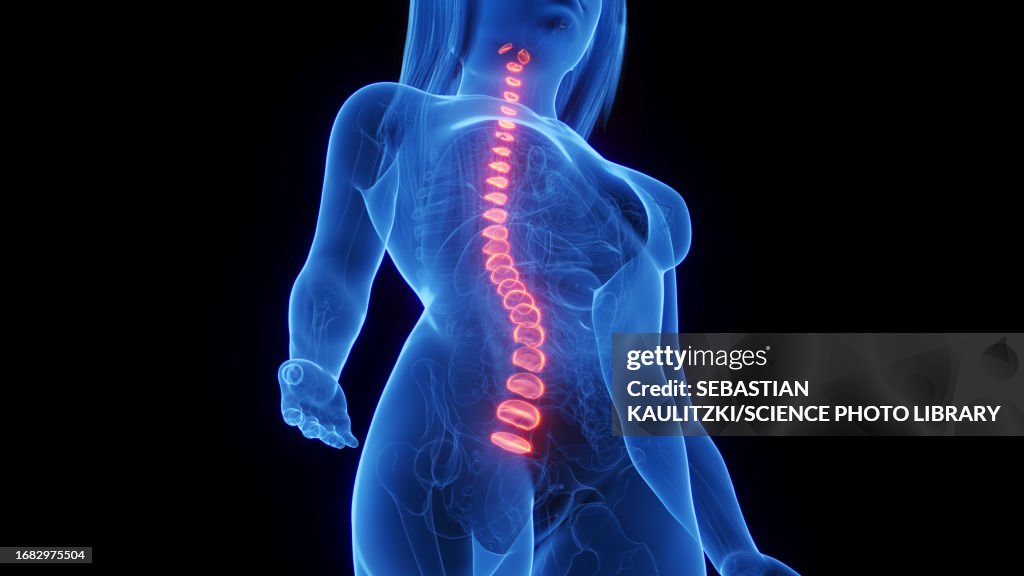 Female intervertebral discs, illustration