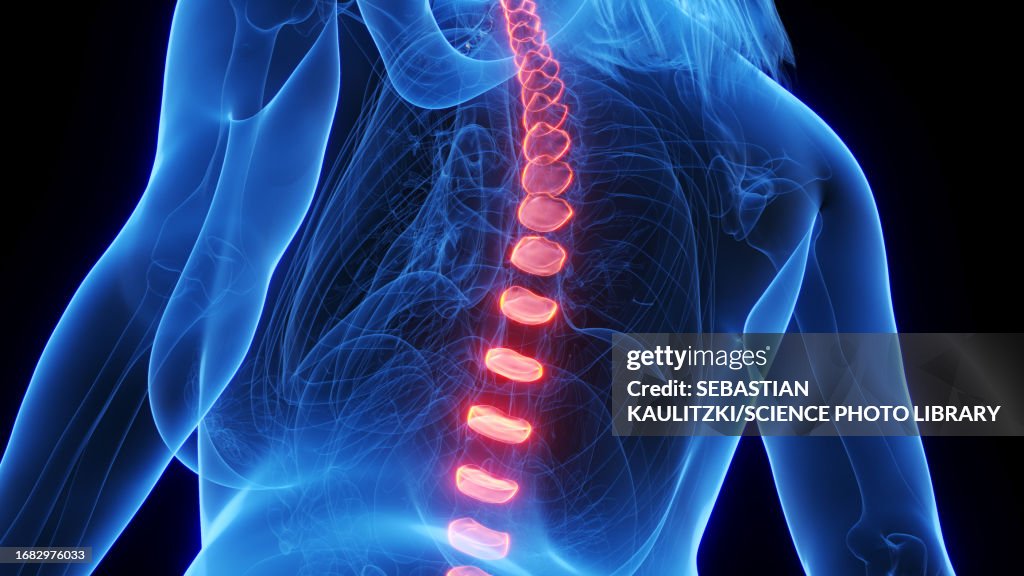 Female intervertebral discs, illustration
