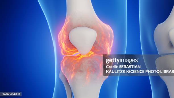 Front Rise Knee 919 Knee Joint Front View Stock Photos, High-Res Pictures, and Images ...