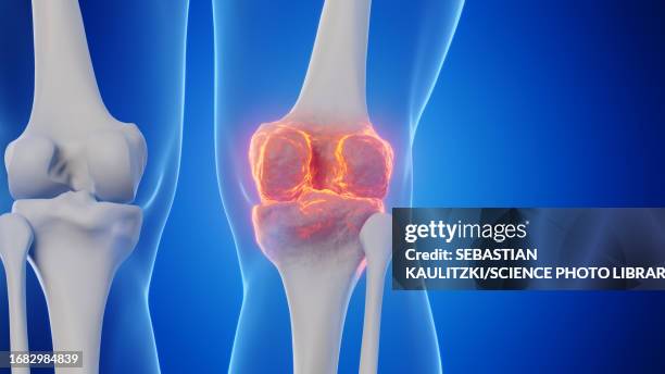 ilustrações, clipart, desenhos animados e ícones de male knee, illustration - joint body part