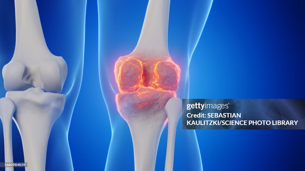 Male knee, illustration