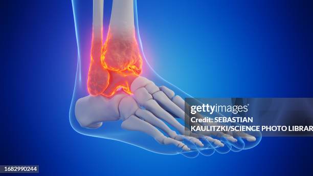 male ankle, illustration - ankle sprain stock illustrations