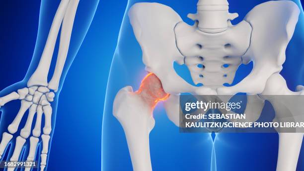 male hip joint, illustration - acetabulum stock illustrations