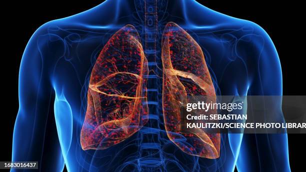 lung infection, illustration - bronchialbaum stock-grafiken, -clipart, -cartoons und -symbole