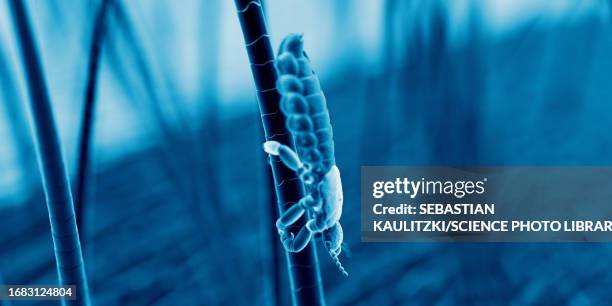 head louse, illustration - head lice stock illustrations