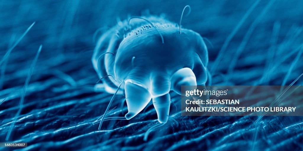 Scabies mite on human skin, illustration