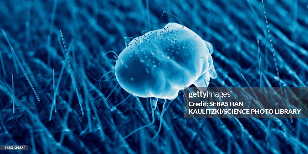Scabies mite on human skin, illustration