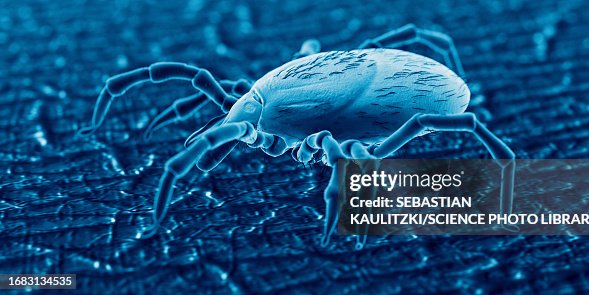 Tick Rash Animation Tick On Human Skin Illustration High-Res Vector Graphic - Getty Images