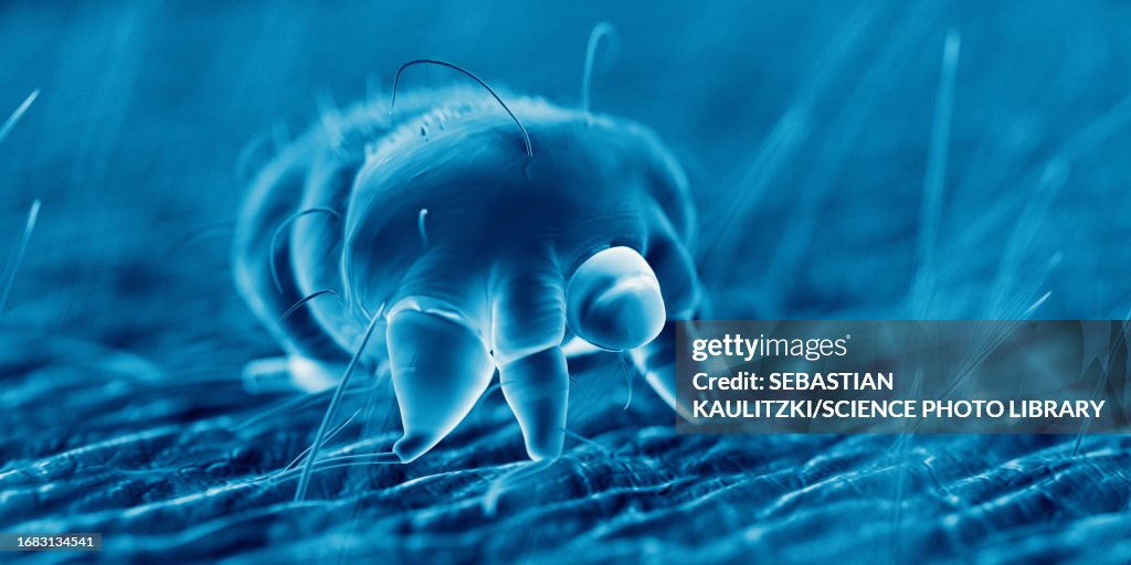 Scabies mite on human skin, illustration