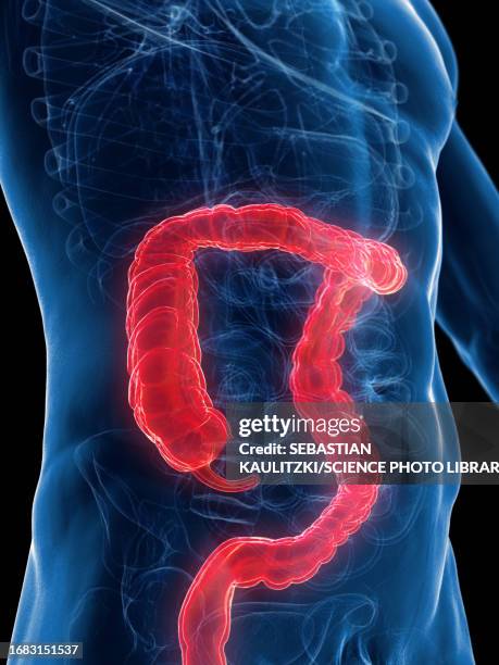 male large intestine, illustration - appendix stock illustrations