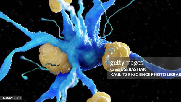 ilustraciones, imágenes clip art, dibujos animados e iconos de stock de nerve cell with amyloid plaques, illustration - autoimmunity