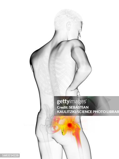 man with a painful hip joint, illustration - physik stock illustrations