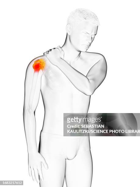 man with a painful shoulder, illustration - acromion stock illustrations