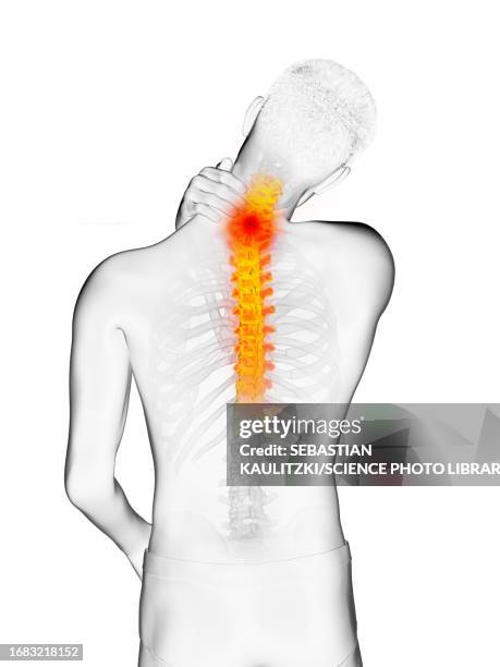 man with a painful upper back, illustration - upper back pain stock illustrations