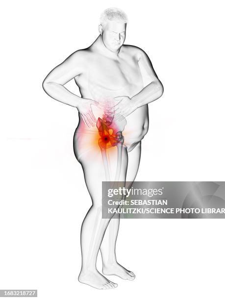 obese man's painful hip joint, illustration - heavy stock illustrations