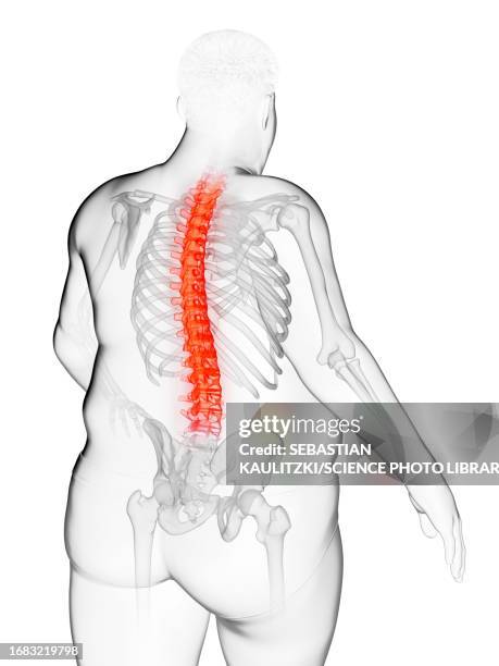 obese man's painful back, illustration - heavy stock illustrations