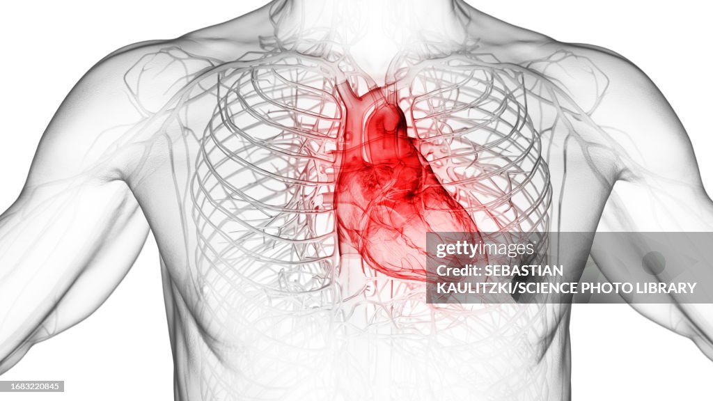Inflamed heart, illustration