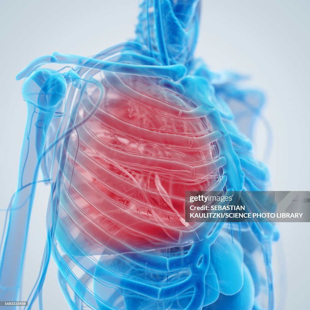 Inflamed Lung Illustration High-Res Vector Graphic - Getty Images
