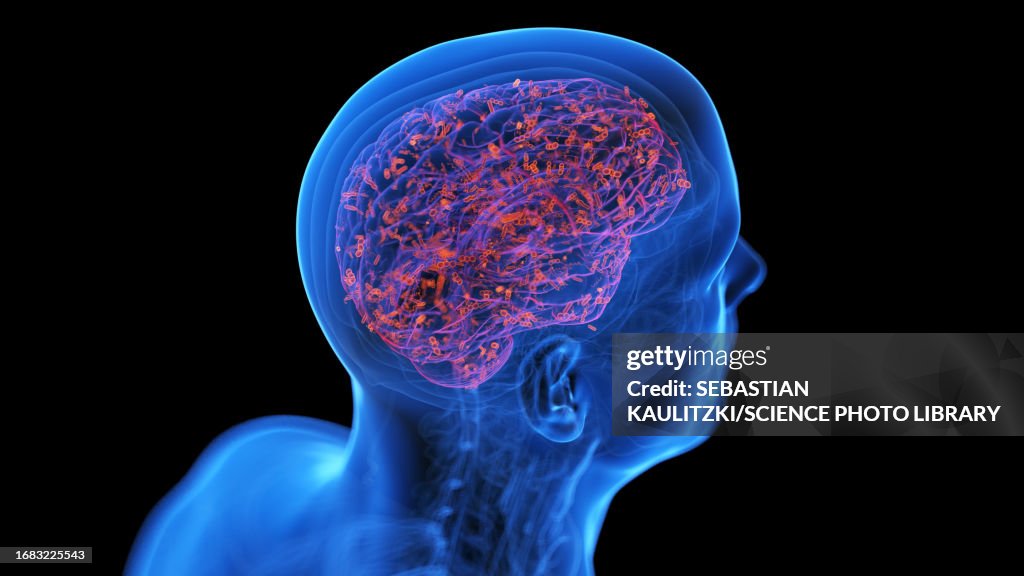 Human Is Infected Infected Human Brain Illustration High-Res Vector Graphic - Getty Images