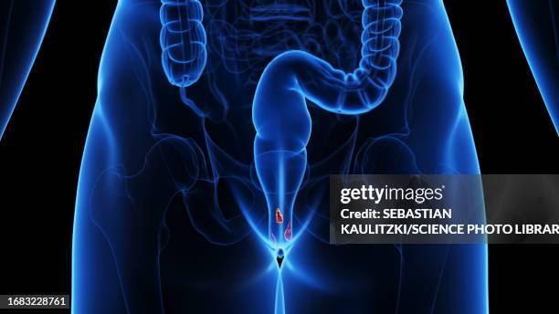 haemorrhoids, illustration - hemorrhoid treatment stock illustrations