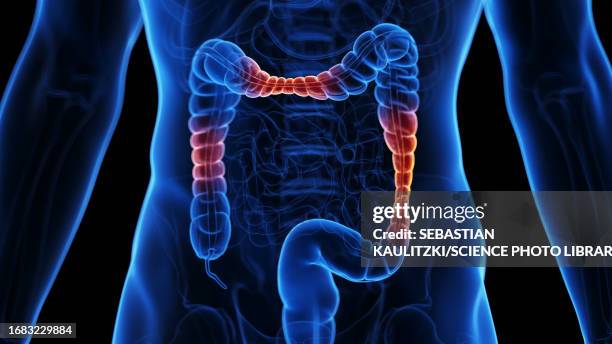 inflammatory bowel disease, illustration - human colon stock illustrations