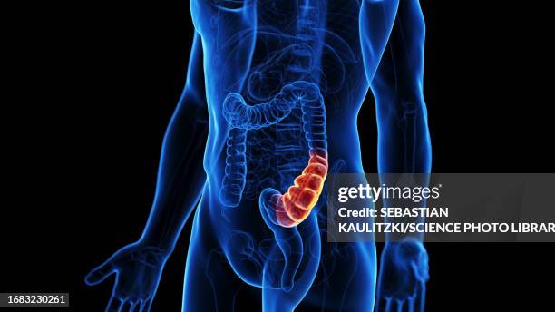 stockillustraties, clipart, cartoons en iconen met constipated colon, illustration - colon