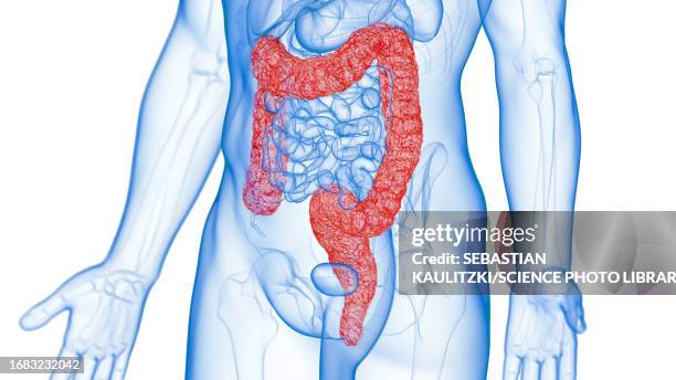 inflamed colon, illustration - descending colon stock-grafiken, -clipart, -cartoons und -symbole