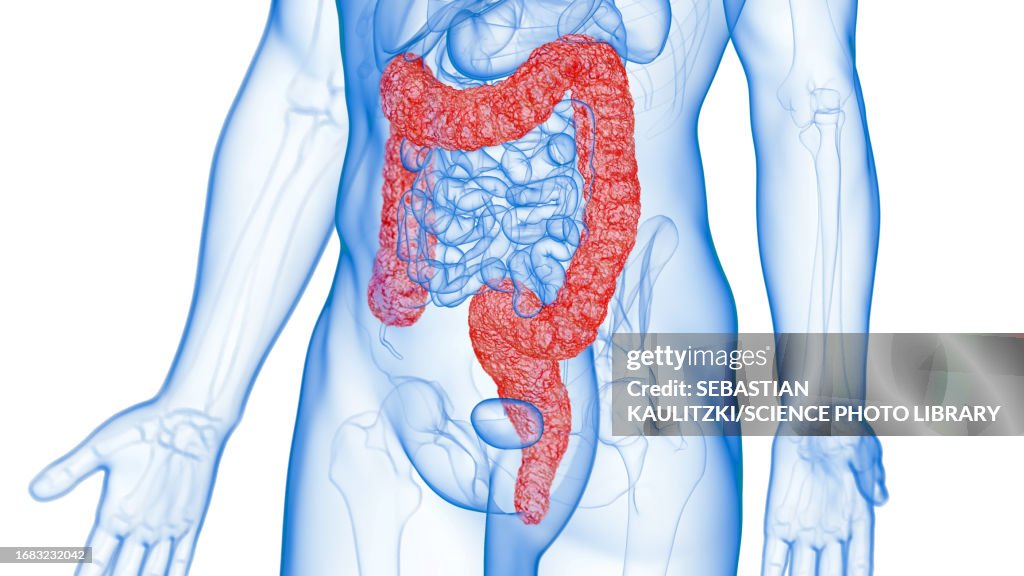 Inflamed Colon Illustration High-Res Vector Graphic - Getty Images