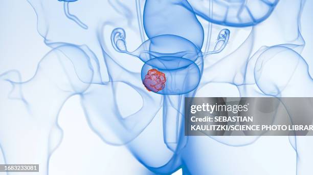 Bladder Pnet 4,257 Bladder Anatomy Stock Photos, High-Res Pictures, and Images ...