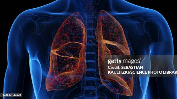lung infection, illustration - thorax stock illustrations