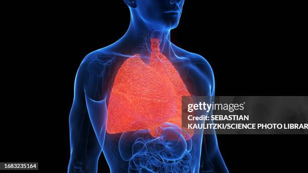 ilustraciones, imágenes clip art, dibujos animados e iconos de stock de inflamed lung, illustration - cystic fibrosis