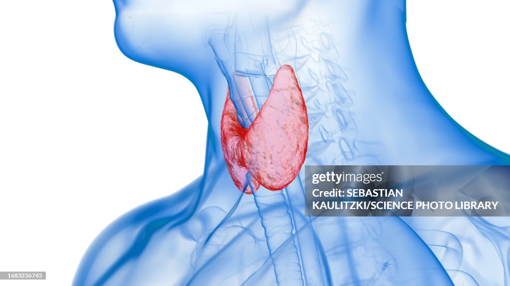 Inflamed thyroid gland, illustration